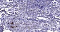 Repetin Polyclonal Antibody