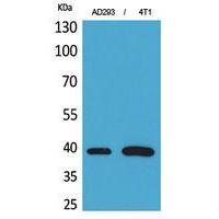 Troponin T-C Polyclonal Antibody