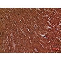 Troponin T-C Polyclonal Antibody