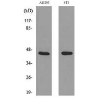 Troponin T-C Polyclonal Antibody
