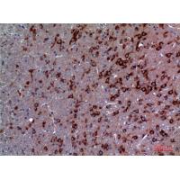 TRPC3 Polyclonal Antibody