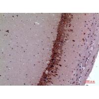 TRPC3 Polyclonal Antibody