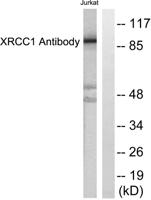 XRCC1 Polyclonal Antibody