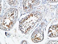YB-1 Polyclonal Antibody