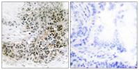 TRPS1 Polyclonal Antibody