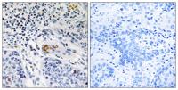 ZBTB40 Polyclonal Antibody