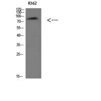 Villin Polyclonal Antibody