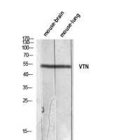 Vitronectin Polyclonal Antibody