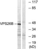 VPS26B Polyclonal Antibody