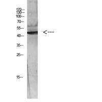 WISP-3 Polyclonal Antibody