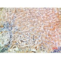 WISP-3 Polyclonal Antibody