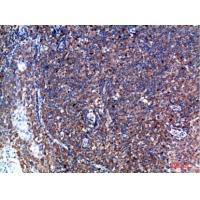 Tryptase-3 Polyclonal Antibody