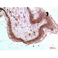 Tryptase-3 Polyclonal Antibody