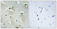 UTP14A Polyclonal Antibody