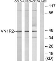 V1RL2 Polyclonal Antibody