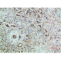 Flk-1/VEGFR2 Polyclonal Antibody