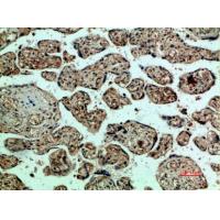 Flk-1/VEGFR2 Polyclonal Antibody