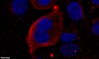 TNF-R2 Polyclonal Antibody
