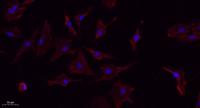 TNF-α Polyclonal Antibody