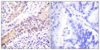 Topo IIβ Polyclonal Antibody