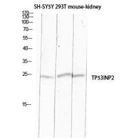 TP53INP2 Polyclonal Antibody
