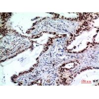 TP53INP2 Polyclonal Antibody