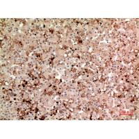 TPO Polyclonal Antibody