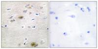 Tra-2α Polyclonal Antibody