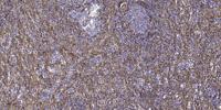 TRAF2 Polyclonal Antibody