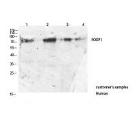 FOXP1 Polyclonal Antibody