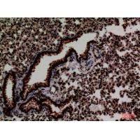 FOXP1 Polyclonal Antibody