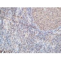 FOXP1 Polyclonal Antibody