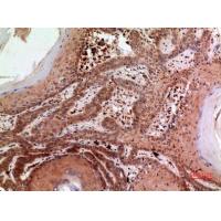 RFC1 Polyclonal Antibody