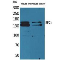 RFC1 Polyclonal Antibody
