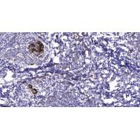 RFC1 Polyclonal Antibody