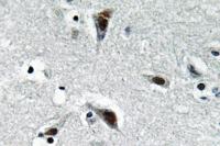 RFC3 Polyclonal Antibody
