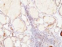 Thyroglobulin Polyclonal Antibody