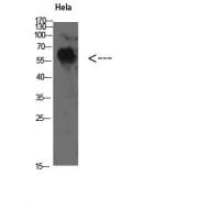 TyrRS Polyclonal Antibody