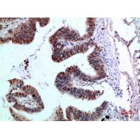 TyrRS Polyclonal Antibody