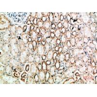 TyrRS Polyclonal Antibody