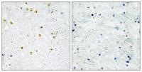 TIF1α Polyclonal Antibody