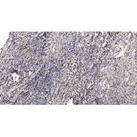 TIM-1 Polyclonal Antibody