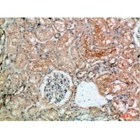 TLE1/2/3/4 Polyclonal Antibody