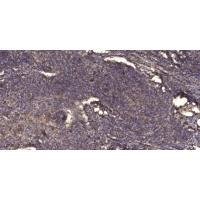 TLE1/2/3/4 Polyclonal Antibody