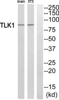 TLK1 Polyclonal Antibody