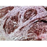TMPO Polyclonal Antibody