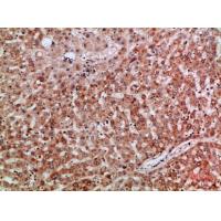 TMPO Polyclonal Antibody