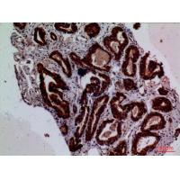 TF Polyclonal Antibody