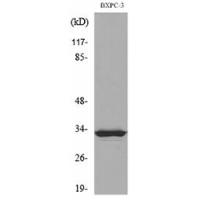 TF Polyclonal Antibody