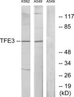TFE3 Polyclonal Antibody